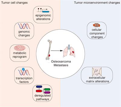 Molecular mechanisms of osteosarcoma metastasis and possible treatment opportunities